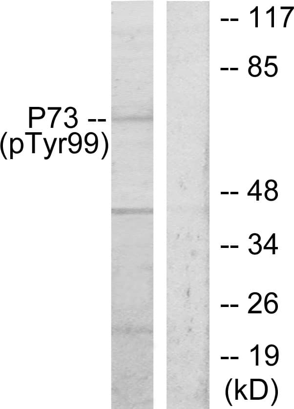 TP73 / p73 Antibody (phospho-Tyr99)