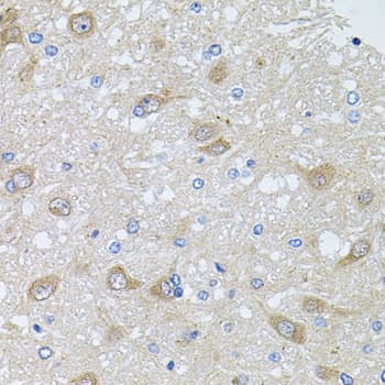 Polyclonal Rabbit anti-Human AKAP5 / AKAP79 Antibody (IHC, WB)