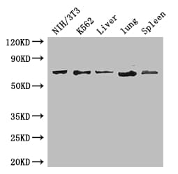IL23R Antibody