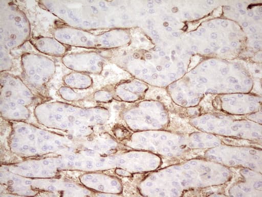 PROCR / EPCR Antibody (aa1-210, clone UMAB200, Carrier-free)