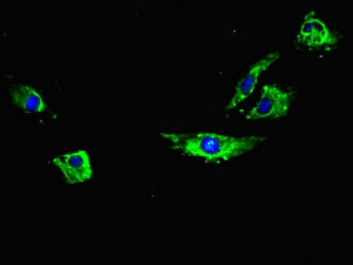 RYR2 / Ryanodine Receptor 2 Antibody