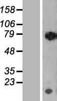 RECQ1 / RECQL Protein (Over-Expression Lysate Myc-DDK (Flag))