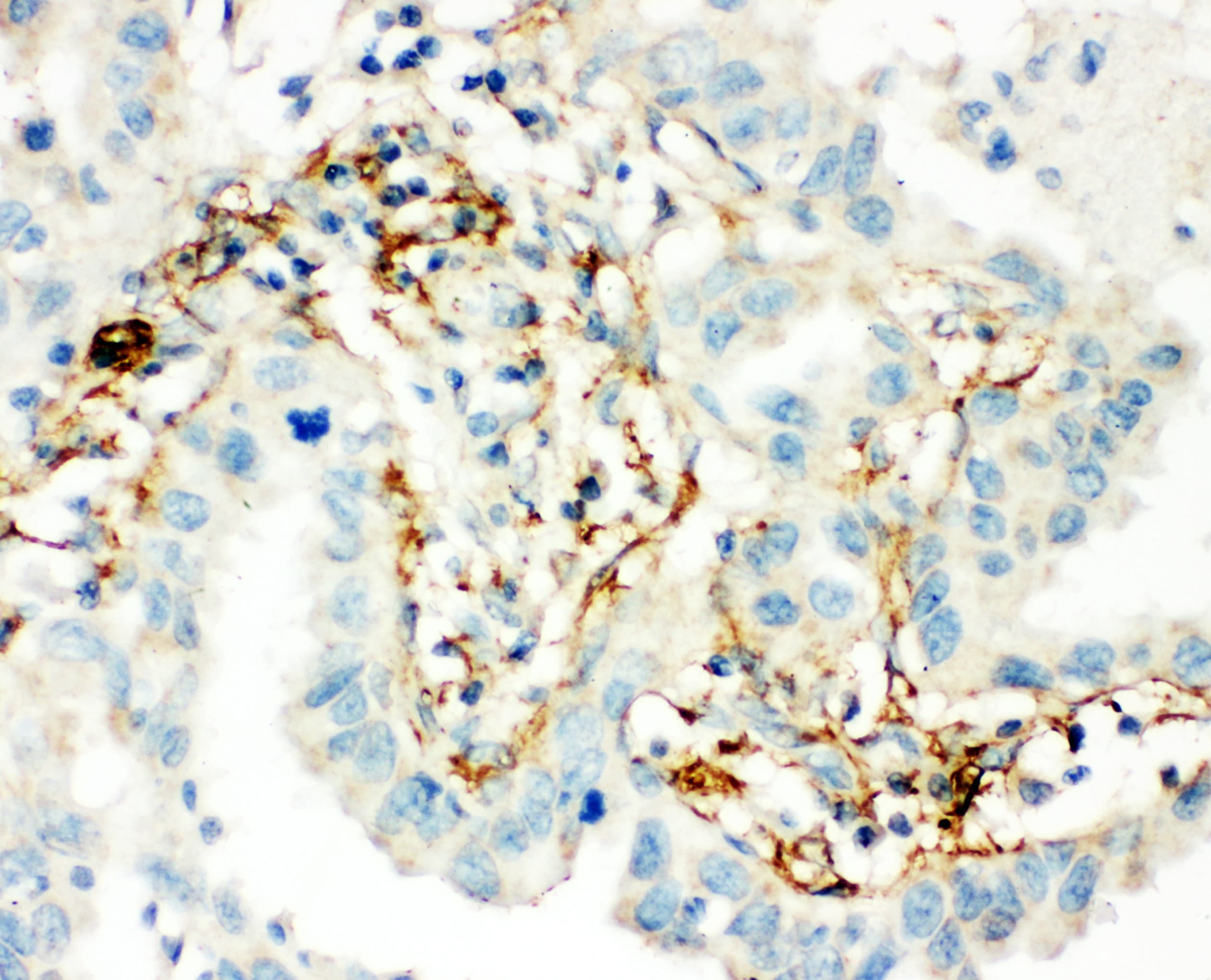 TGM2 / Transglutaminase 2 Antibody (aa399-418)
