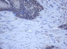 Monoclonal Mouse anti-Human DDX59 Antibody (clone OTI2G1, IHC, WB)