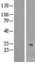 YAE1D1 Protein (Over-Expression Lysate Myc-DDK (Flag))