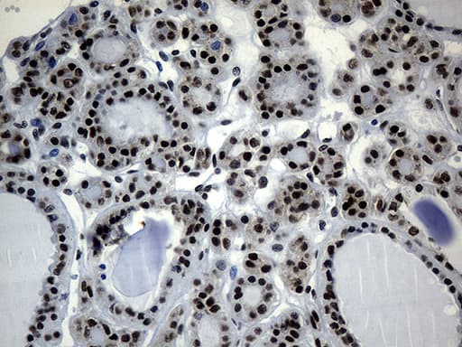 POLR2A / RNA polymerase II Antibody (aa1351-1614, clone OTI2B7)