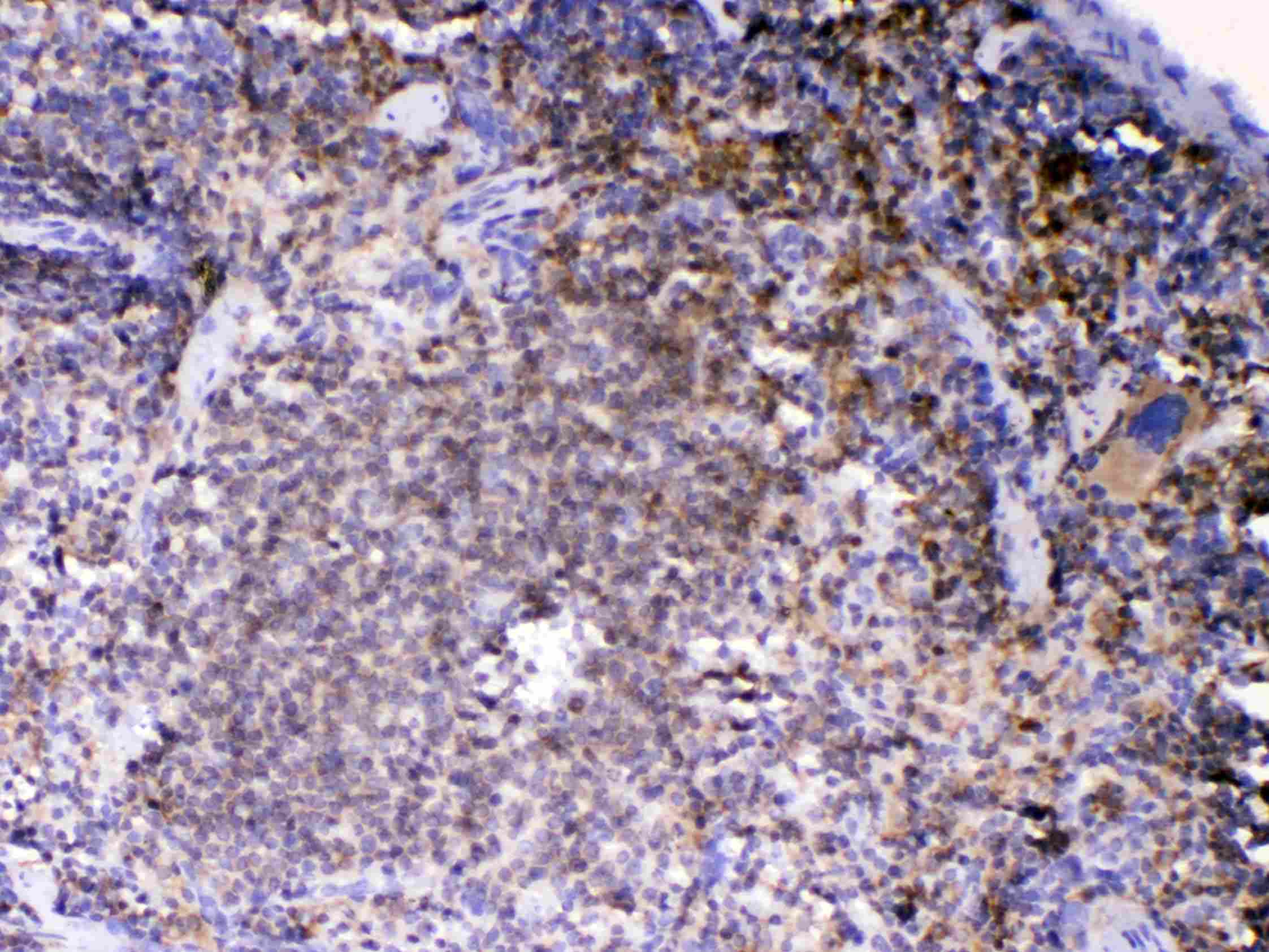 Polyclonal Rabbit anti-Human LYN Antibody (IHC, WB)