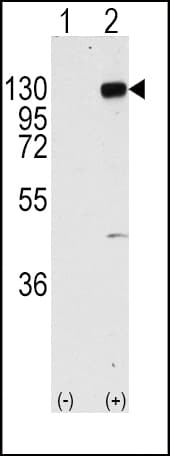 FGFR1 / FGF Receptor 1 Antibody (Tyr766)