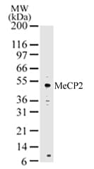 IHC-plus™ Polyclonal Rabbit anti-Human MECP2 Antibody (aa11-25, IHC, WB)