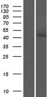 AGK Protein (Over-Expression Lysate Myc-DDK (Flag))