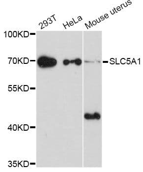 SLC5A1 / SGLT1 Antibody