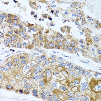 PEX14 Antibody