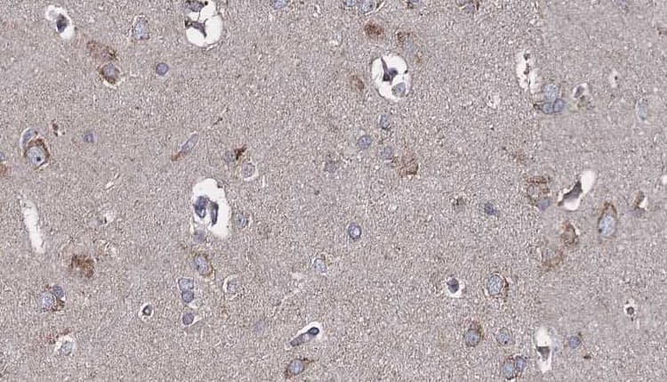 Polyclonal Rabbit anti-Human TLR3 Antibody (IHC, WB)