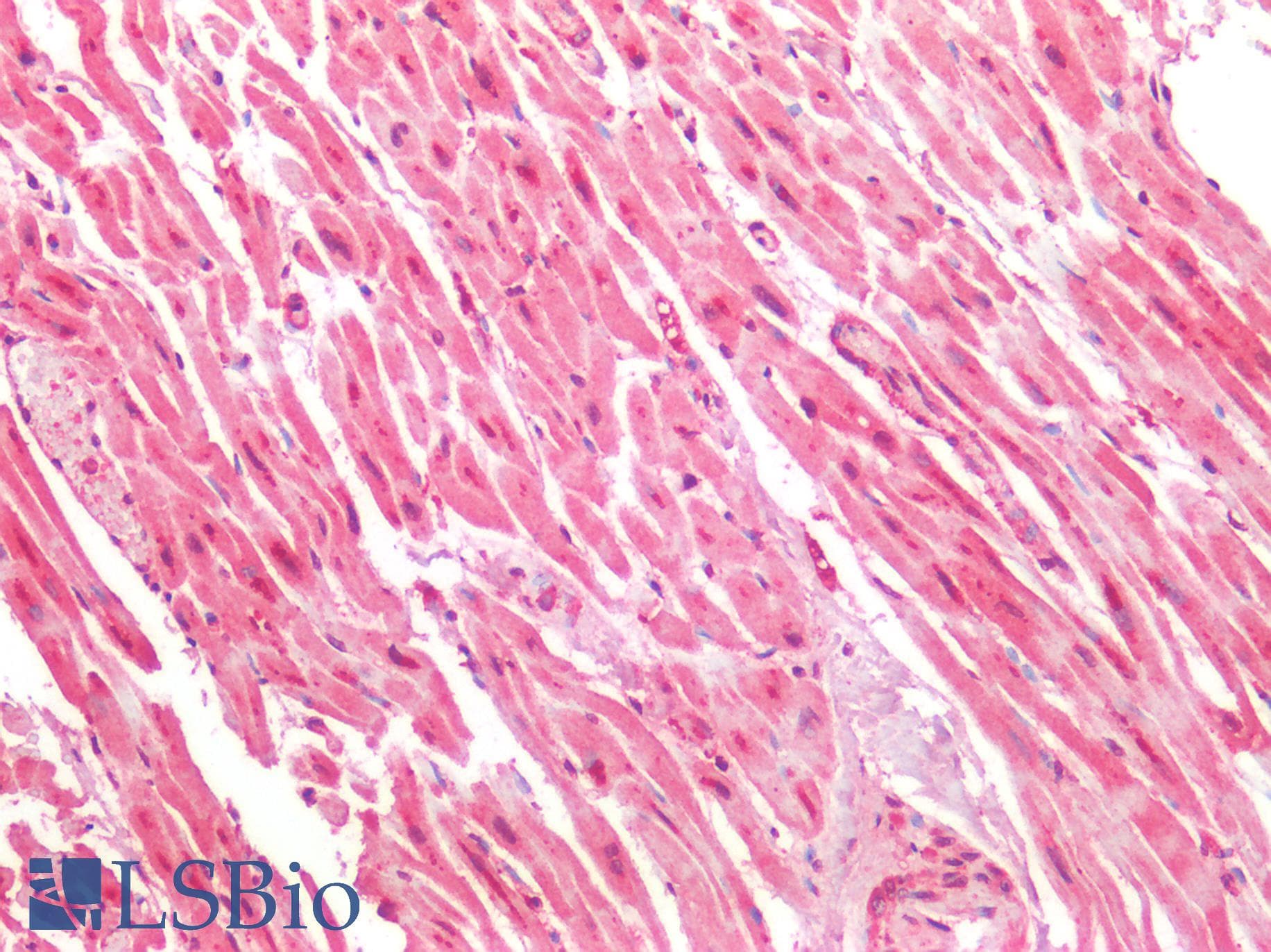 IHC-plus™ Polyclonal Rabbit anti-Rat HTR1A / 5-HT1A Receptor Antibody (Internal, IHC, WB)