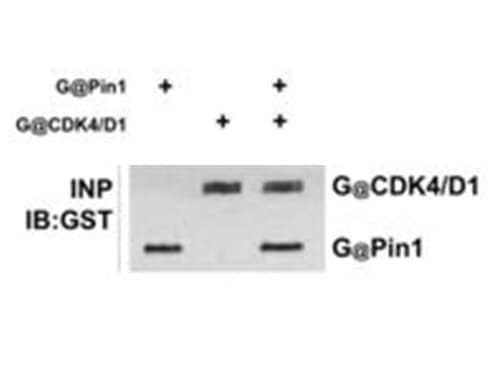 GST / Glutathione S-Transferase Antibody