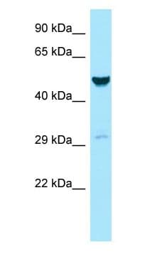GALK2 Antibody (C-Terminus)