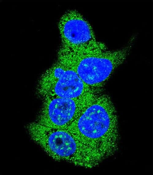 IHC-plus™ ALDOA / Aldolase A Antibody (aa66-95)
