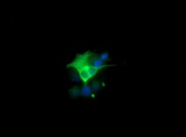 CHGA / Chromogranin A Antibody (clone OTI2B11)