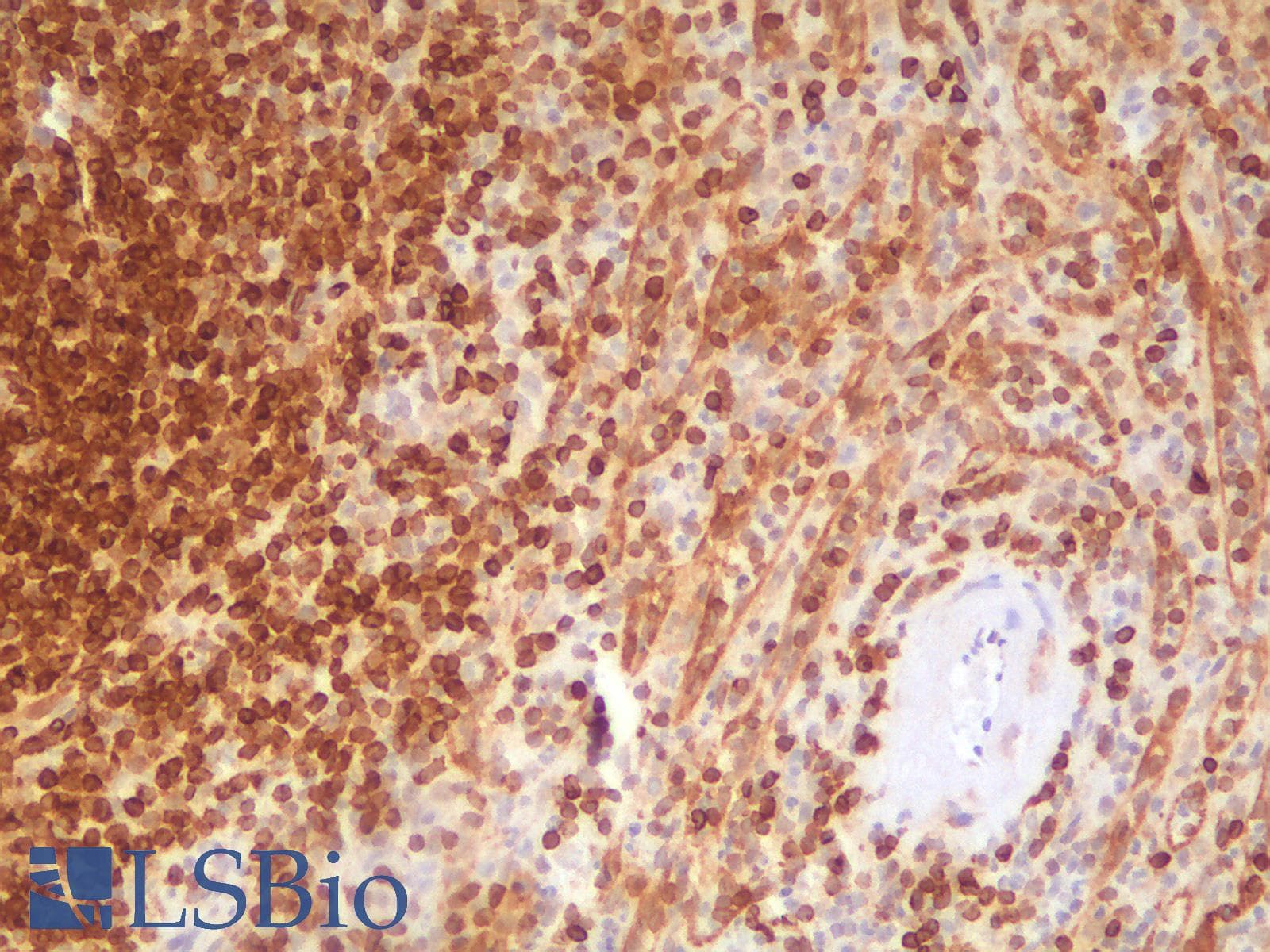 PathPlus™ BCL2 / Bcl-2 Antibody (clone rBCL2/796)