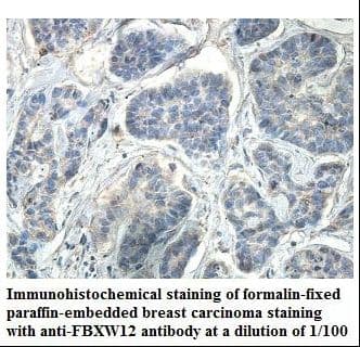 FBXW12 Antibody (aa1-178)