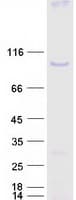 Human BACH1 Protein (Recombinant Myc-DDK (Flag))