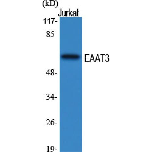 Polyclonal Rabbit anti-Human SLC1A1 / EAAT3 Antibody (Internal, WB)