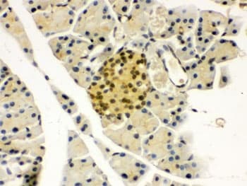 Polyclonal Rabbit anti-Human PAX6 Antibody (IHC, WB)