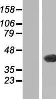 CTG-B45d / THAP11 Protein (Over-Expression Lysate Myc-DDK (Flag))