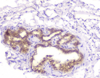 CHM / REP1 Antibody