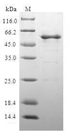 Human CLTA / LCA Protein (Recombinant GST, N-terminus)
