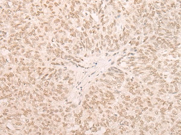 EIF4A3 Antibody
