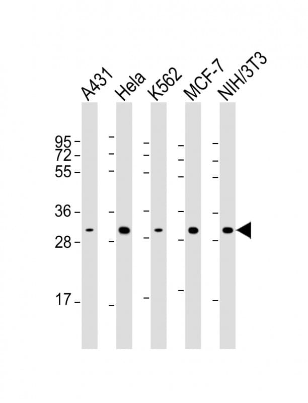 Monoclonal Mouse anti-Human CDK4 Antibody (clone 1529CT850.162.73, IHC, WB)
