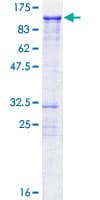 Human KIZ / PLK1S1 Protein (Recombinant GST)