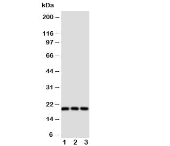 Polyclonal Rabbit anti-Human THY1 / CD90 Antibody (aa20-39, WB)