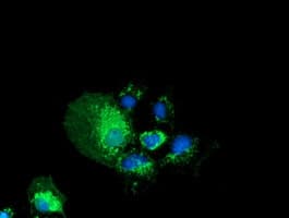 P5CR2 / PYCR2 Antibody (clone OTI2F11)