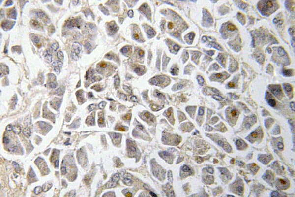 Polyclonal Rabbit anti-Human SMAD3 Antibody (Met200, IHC, WB)