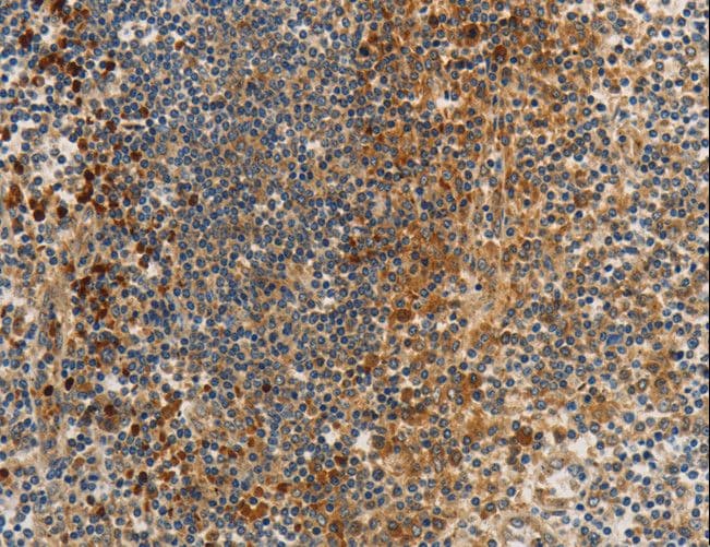 Polyclonal Rabbit anti-Human PP2CB / PPP2CB Antibody (IHC)