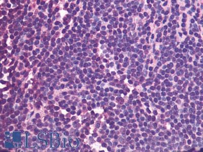 IHC-plus™ CXCR5 Antibody (Cytoplasmic Domain)