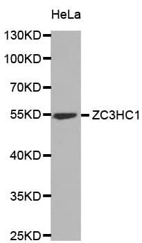 Polyclonal Rabbit anti-Human ZC3HC1 / NIPA Antibody (IHC, WB)