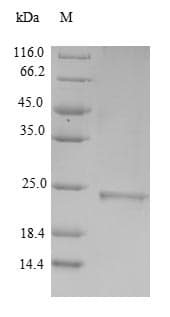 Human MUT / MCM Protein (Recombinant 6His, N-terminus)
