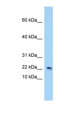 4E-BP2 / EIF4EBP2 Antibody (aa7-56)
