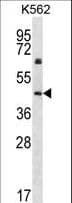Polyclonal Rabbit anti-Human KRT12 / CK12 / Cytokeratin 12 Antibody (aa442-471, IHC, WB)