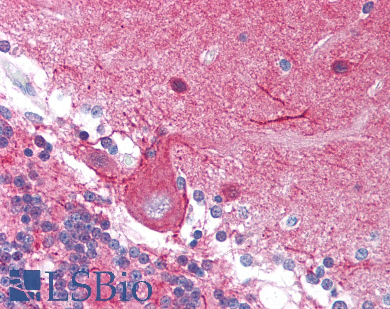 PathPlus™ STMN1 / Stathmin / LAG Antibody (Ser37)