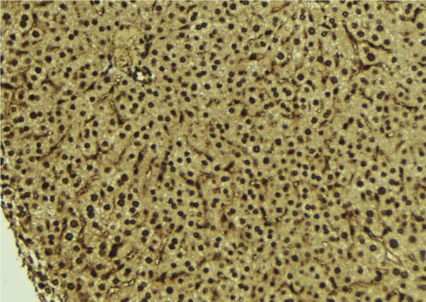 REV1 Antibody