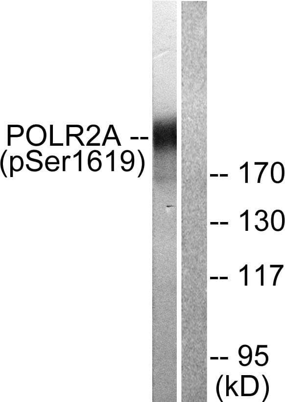 Polyclonal Rabbit anti-Human POLR2A / RNA polymerase II Antibody (phospho-Ser1619, IHC, IF, WB)