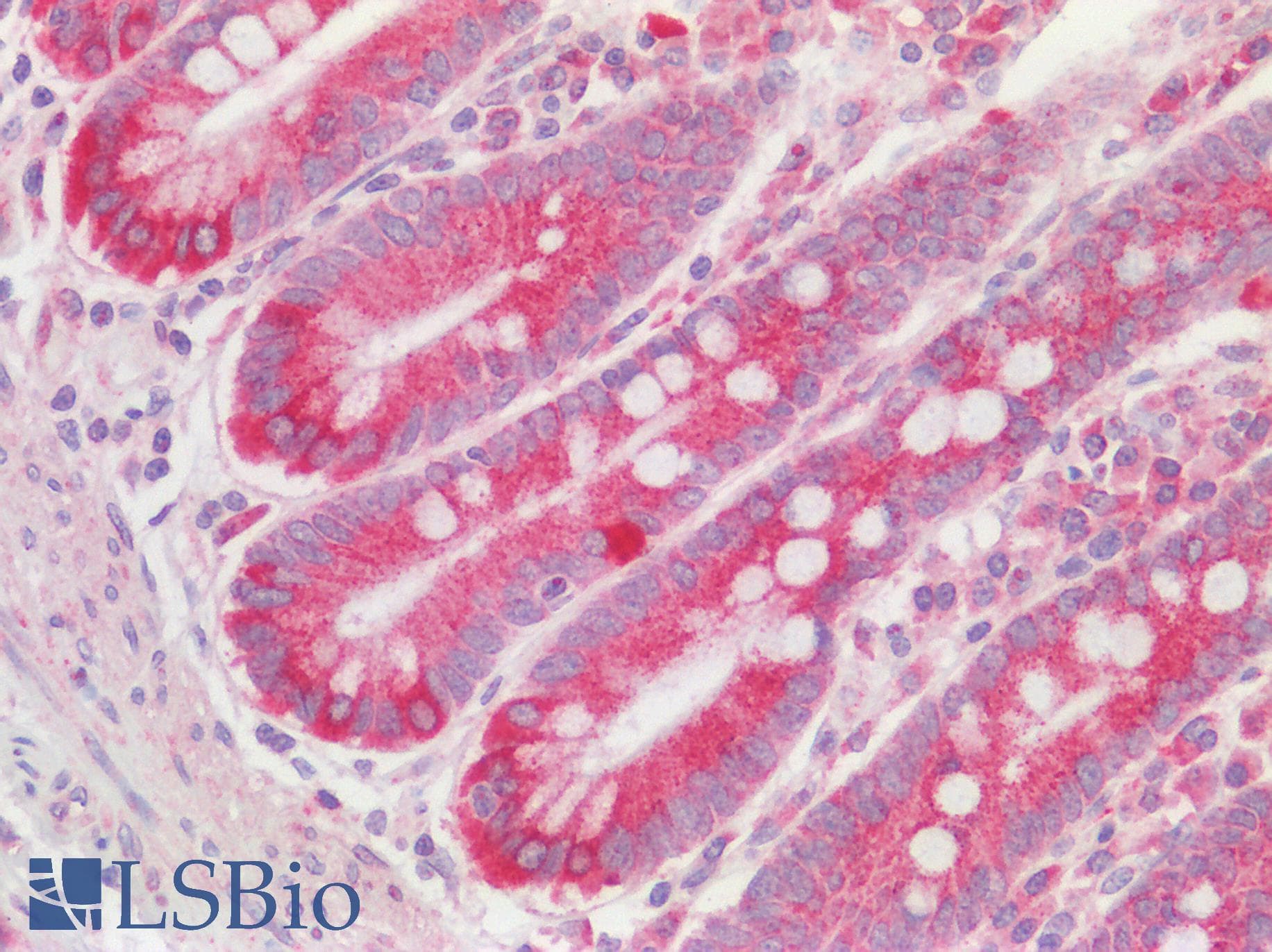 GCS1 / MOGS Antibody (aa144-193)
