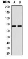 PIAS4 / PIASY Antibody (C-Terminus)