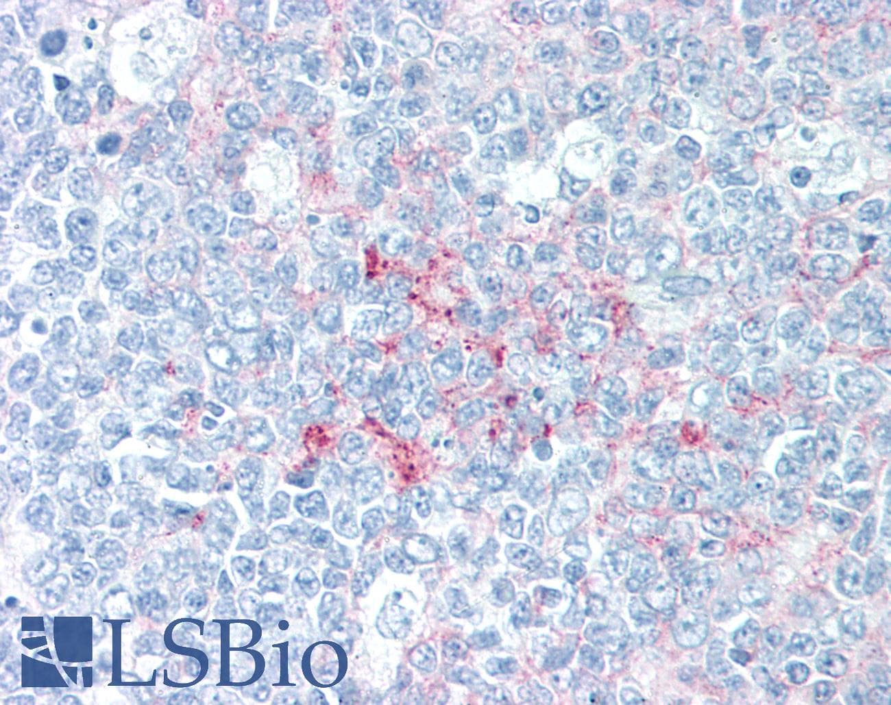 PathPlus™ CD14 Antibody