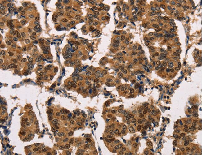 MNK / ATP7A Antibody