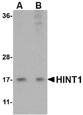 IHC-plus™ HINT / HINT1 Antibody